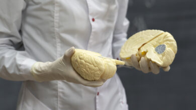 KENDİ KENDİNİ TAMİR EDEN “BİLGİSAYAR FABRİKASI”: BEYİN