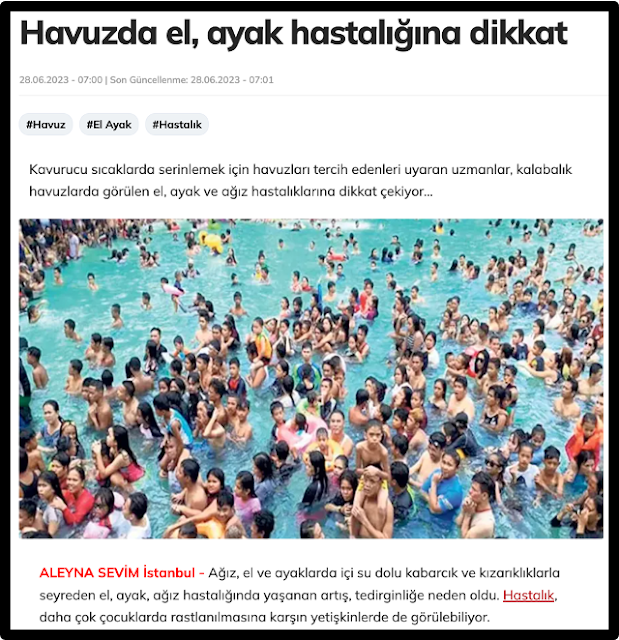 havuzda el ayak hastalığı